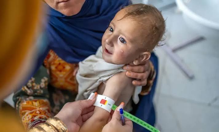 UNICEF Warns 3.7 Million Afghan Children Face Heightened Risk of Malnutrition in 2026